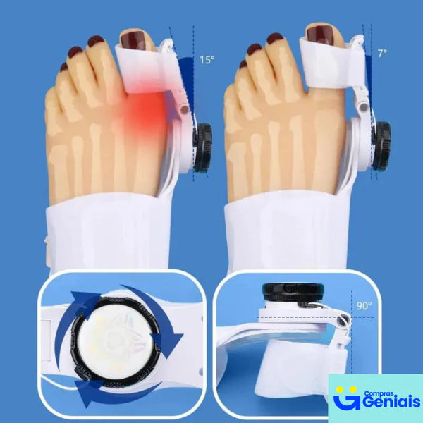 Corrector de Juanetes Ortopédico Ultra®