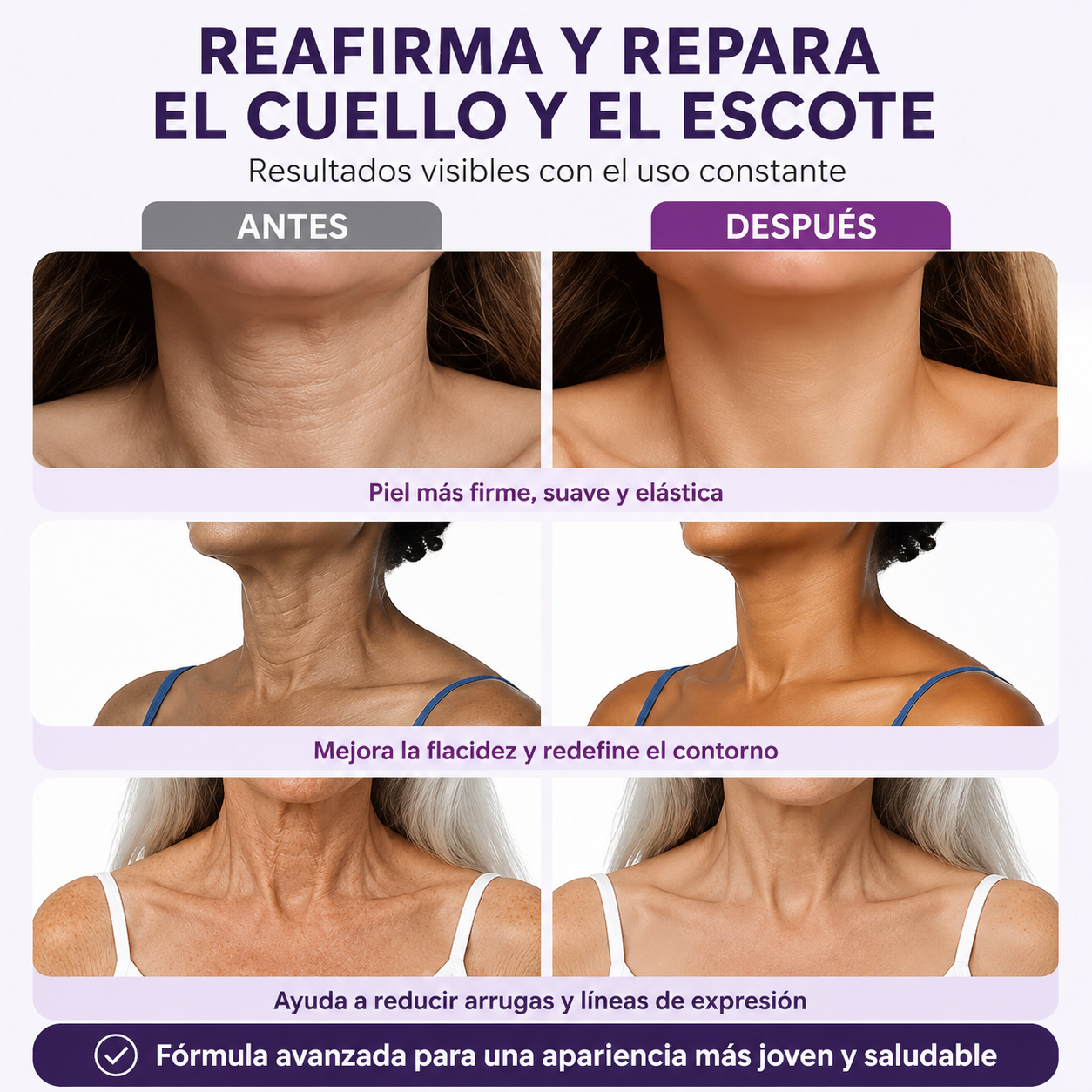 Crema de masaje para el cuello con rodillo 🧴 Colágeno y ácido hialurónico | Reafirma el cuello, reduce las arrugas y la papada
